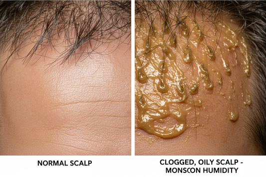 Monsoon Hair Fall in India: 9 Causes &amp; Fixes (2026)